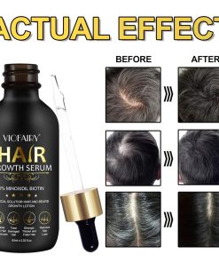 Viofairy Hair Growth Serum 5% Minoxidil Biotin - 60 ml