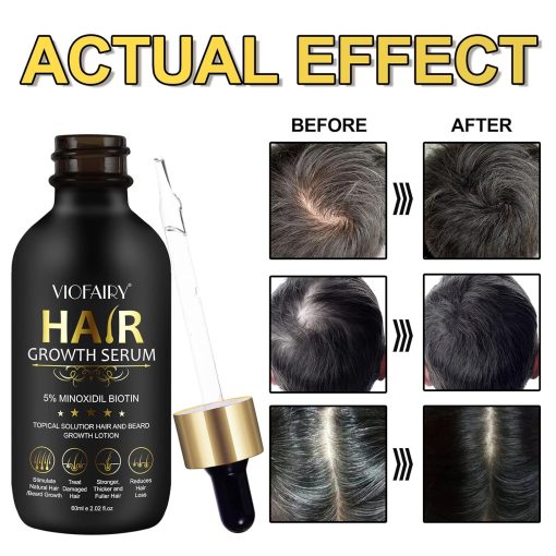 Viofairy Hair Growth Serum 5% Minoxidil Biotin - 60 ml