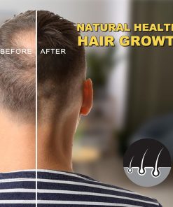 Viofairy Hair Growth Serum 5% Minoxidil Biotin - 60 ml