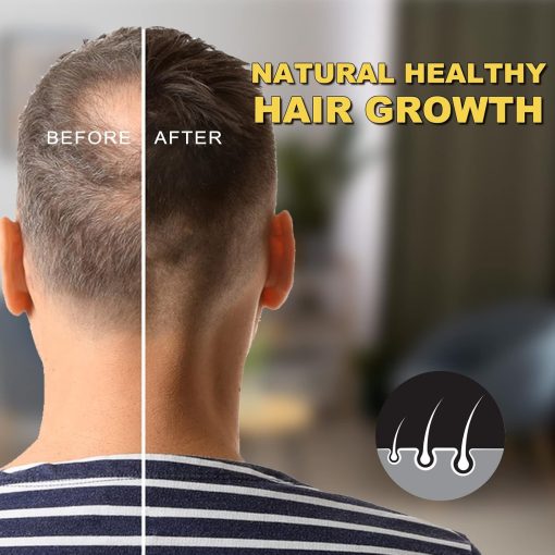 Viofairy Hair Growth Serum 5% Minoxidil Biotin - 60 ml