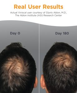 Viviscal Nourishes Thinning Hair and Promotes Existing Hair Growth Man - 180 tablets