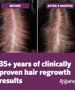 Rogaine Women's 5% Minoxidil Foam Unscented - two 60 gram cans